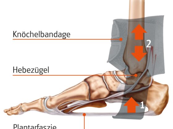 Valley Fersensporn Bandage Grafik -